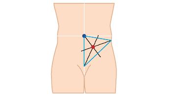 Avanteen merkitseminen